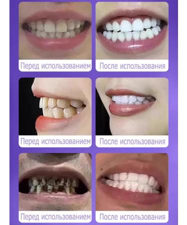 Lanthome Whitening corrective toothpaste V34 - Buy Online on GoSupps.com