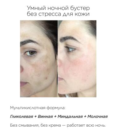 beeJele Serum booster antipigment - Buy Online on GoSupps.com