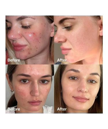 Medicube Serum with amber acid Red Succinic Acid Serum 30ml - Buy Online on GoSupps.com