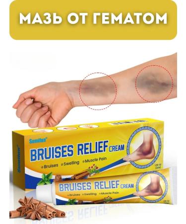 remini322 Bruises and hematomas