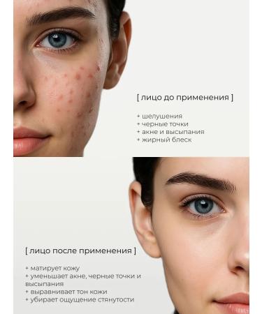 sadoer Foam for washing the face from acne 100 g - Buy Online on GoSupps.com