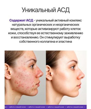 Isis Foam for washing for oily and combined skin 160 ml - Buy Online on GoSupps.com