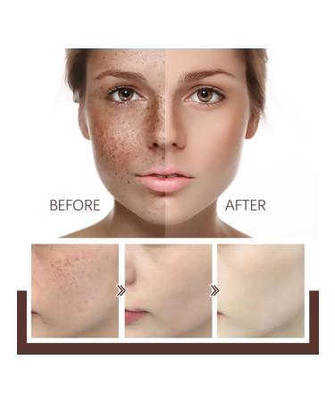 Jaysuing mask-piling to eliminate stains - Buy Online on GoSupps.com