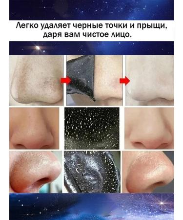 The mask from black dots stretches the black dots of acne 100 g - Buy Online on GoSupps.com