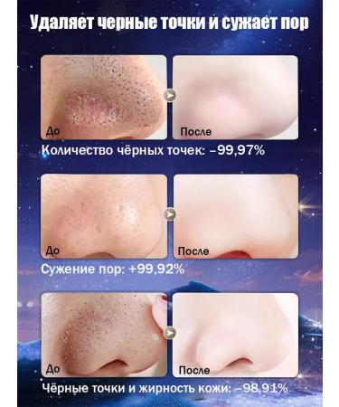 The mask from black dots stretches the black dots of acne 100 g - Buy Online on GoSupps.com