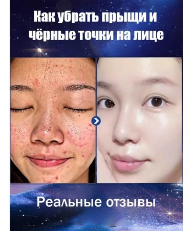 The mask from black dots stretches the black dots of acne 100 g - Buy Online on GoSupps.com