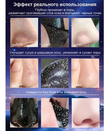 The mask from black dots stretches the black dots of acne 100 g - Buy Online on GoSupps.com