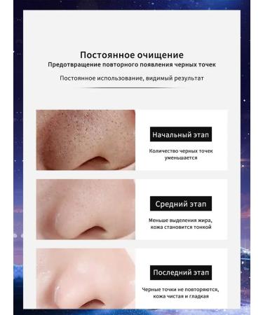 The mask from black dots stretches the black dots of acne 100 g - Buy Online on GoSupps.com