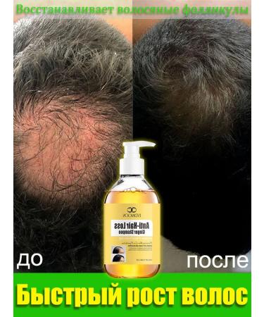 LYDIMOON Shampoo against hair loss with ginger extract