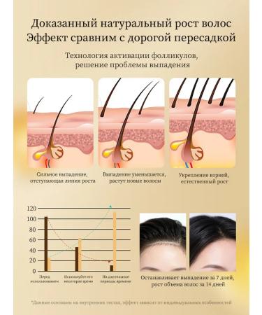 LYDIMOON Shampoo against hair loss with ginger extract - Buy Online on GoSupps.com