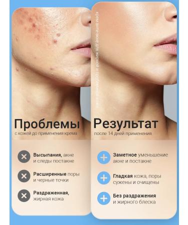 Capital pharm product Pimpling cream on the face with Metrin retinol - Buy Online on GoSupps.com