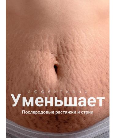 Capital pharm product Cream from scars and scars from Mepiform stretch marks - Buy Online on GoSupps.com