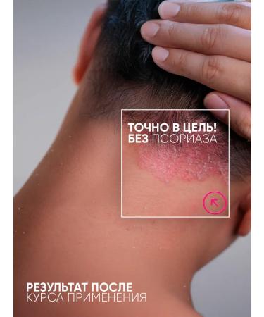 VIS MEDICUS Acne cream for face - Buy Online on GoSupps.com