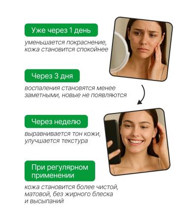 SUAVISS Facial and body cream SOS from inflammation insect bites - Buy Online on GoSupps.com