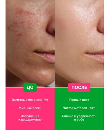SUAVISS Facial and body cream SOS from inflammation insect bites - Buy Online on GoSupps.com