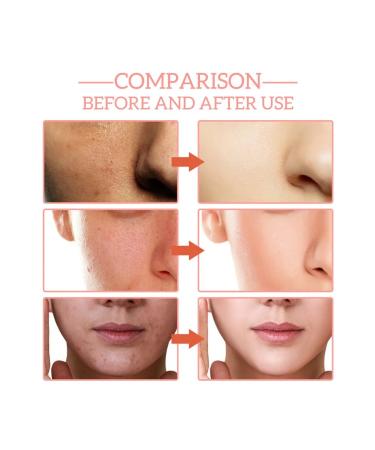 JaySuing Features and Nutrum Facial Wastea - Buy Online on GoSupps.com