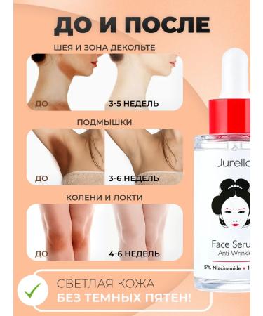 Jurello Whitening face cream niacinamide - Buy Online on GoSupps.com