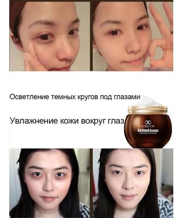 LYDIMOON Eye cream against wrinkles from dark circles - Buy Online on GoSupps.com
