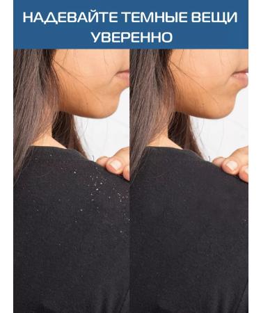MINOXIN  - Buy Online on GoSupps.com