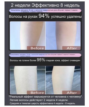 Laser hair removal for women - Buy Online on GoSupps.com