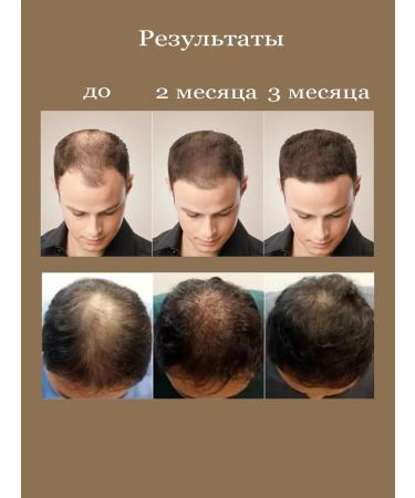 Bellessa&Elena Concentrated essential hair for hair growth "PURC" - Buy Online on GoSupps.com