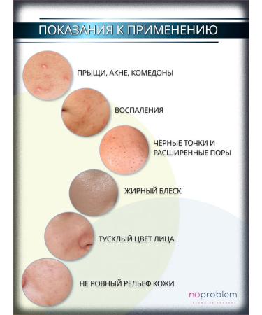 No problem Salicylic gel from acne on the face for oily skin 15 ml - Buy Online on GoSupps.com