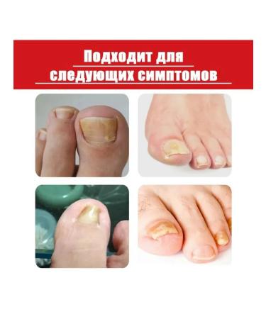 NOG protection against infections contribute to the growth of care of entity - Buy Online on GoSupps.com