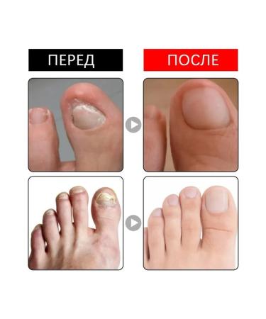 NOG protection against infections contribute to the growth of care of entity - Buy Online on GoSupps.com