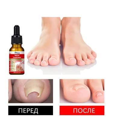 NOG protection against infections contribute to the growth of care of entity - Buy Online on GoSupps.com