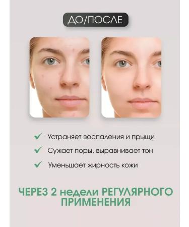 Heimish Foam cleansing for the face All Clean Green Foam 5.5 pH - Buy Online on GoSupps.com