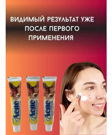 My Sweet Home Acne cream against acne - Buy Online on GoSupps.com