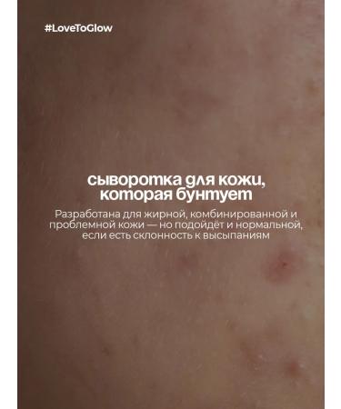 LoveToGlow Facial serum from acne and acne - Buy Online on GoSupps.com