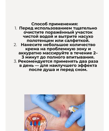 ShaStyle1 Remedy for bruises bruises and muscle pain - Buy Online on GoSupps.com