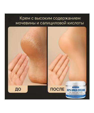 Cream for legs and hands moisturizing from cracks - Buy Online on GoSupps.com