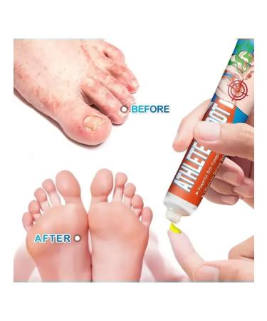 Sumifun Cream from corns and smell of legs - Buy Online on GoSupps.com