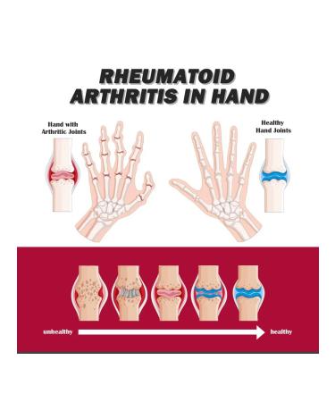 South Moon Collagen Cream for Joints - Buy Online on GoSupps.com