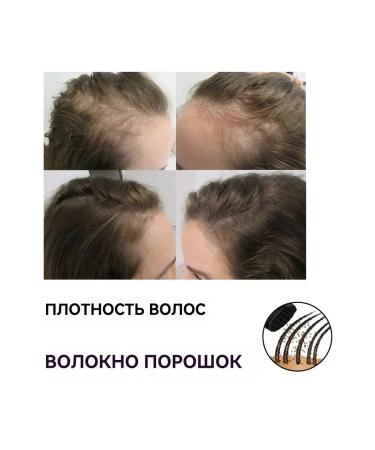 eelhoe Fill in hair seam powder thick hair hair growth 12 g - Buy Online on GoSupps.com