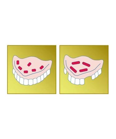 Protefix Extra -horsepower Cream 47 g - 4 pcs - Buy Online on GoSupps.com