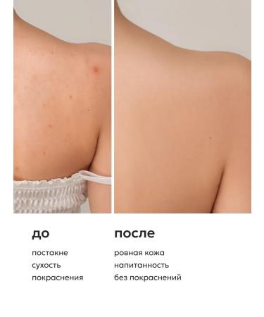 Likato professional Shower gel with acne acids 250 ml - Buy Online on GoSupps.com