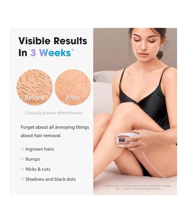 Laser epilator - Buy Online on GoSupps.com