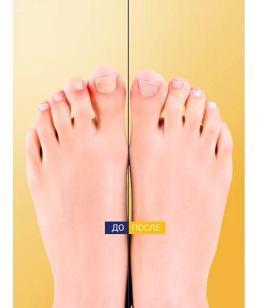 Epideril Feet cream from fungus and smell of sweat 30ml - Buy Online on GoSupps.com