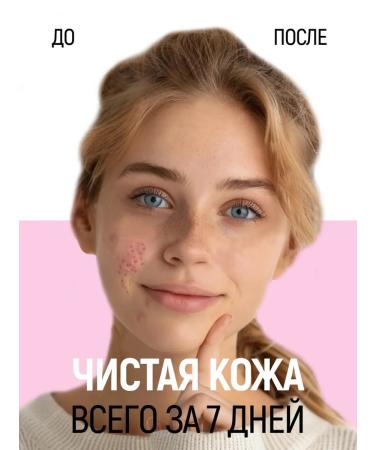 SIBERINA Natural mask cleansing against acne - Buy Online on GoSupps.com