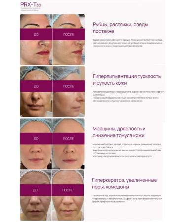 PRXT33 PILing PRX-T 33 4 ml - Buy Online on GoSupps.com