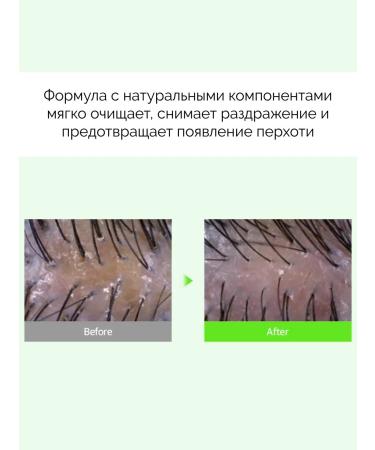 Derma:B Hypoallergenic hair shampoo - Buy Online on GoSupps.com