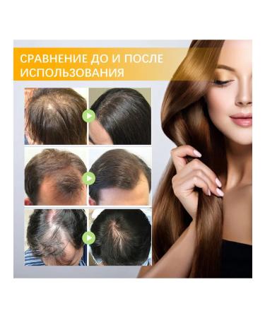Biotin Oil for Hair Care Deep Moisturizing - Buy Online on GoSupps.com