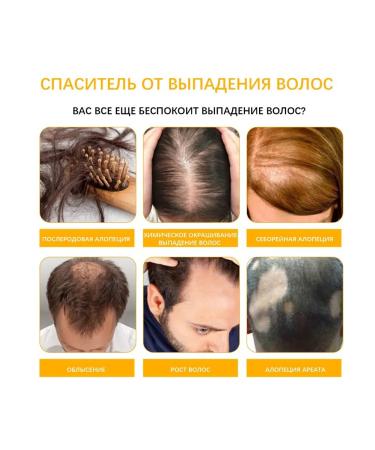 Biotin Oil for Hair Care Deep Moisturizing - Buy Online on GoSupps.com