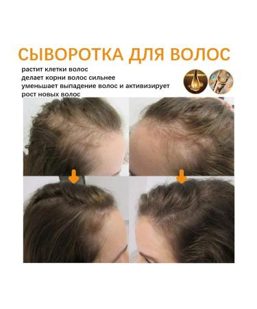Biotin Oil for Hair Care Deep Moisturizing - Buy Online on GoSupps.com