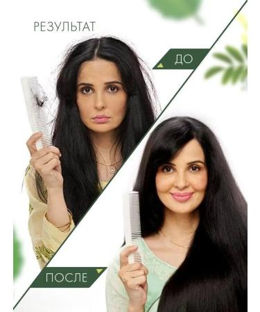 Cash King Hair oil from falling out natural healing - Buy Online on GoSupps.com