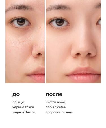 Likato professional A set of face creams from post -acne and acne 2 pcs - Buy Online on GoSupps.com