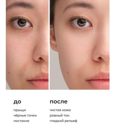 Likato professional Facial complex Enzyme powder and cream with niacinamide - Buy Online on GoSupps.com